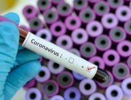 Do sada dvoje novinara oboljelo od koronavirusa u BiH