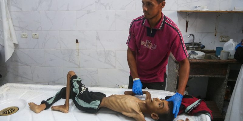 About EFJ News Projects Policy Resources Our letter to the EU on Gaza: starvation as a weapon, silence as complicity